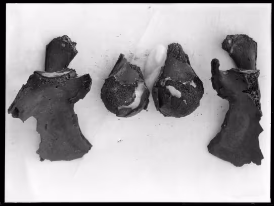 Image of negative of bone fragments