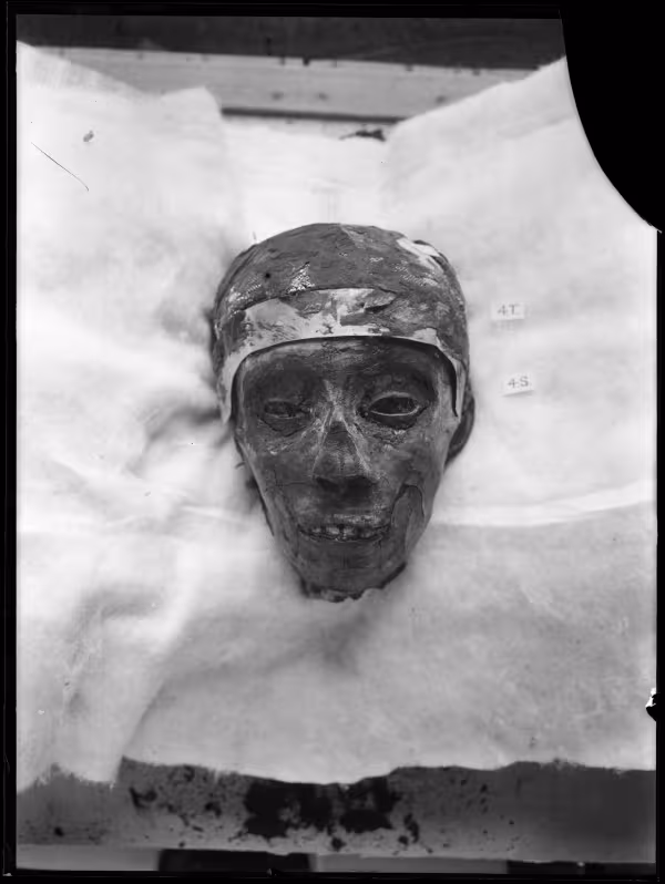 Image of negative of king's head disattached from mummy, wearing golden band around temple