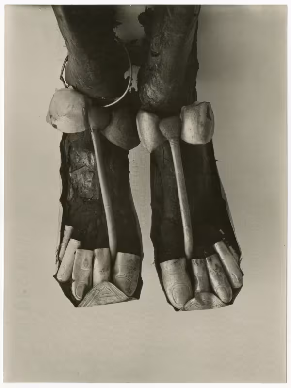 Image of print of feet with sandals and toe stalls