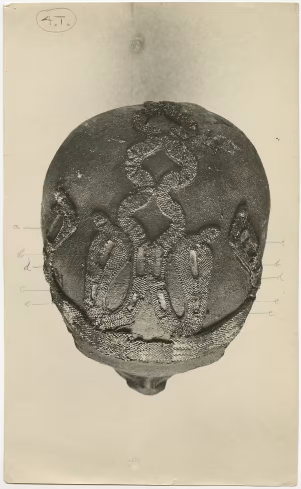 image of photographic print of top of king's head with annotations in object card