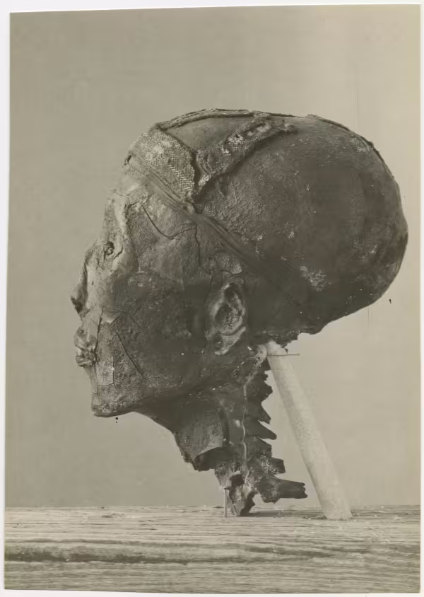 image of photographic print of side of king's head in object card