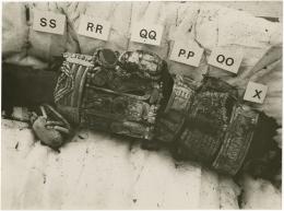 Image of print of mummified arm with bracelets
