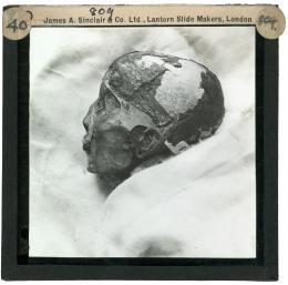 Image of lantern slide of head of king's mummy