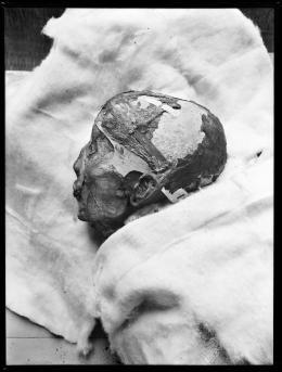 Image of negative of king's head disattached from mummy, wearing a skull cap
